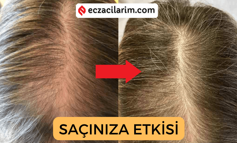 Cilt için En İyi Tip 1-3 Kolajen Markası